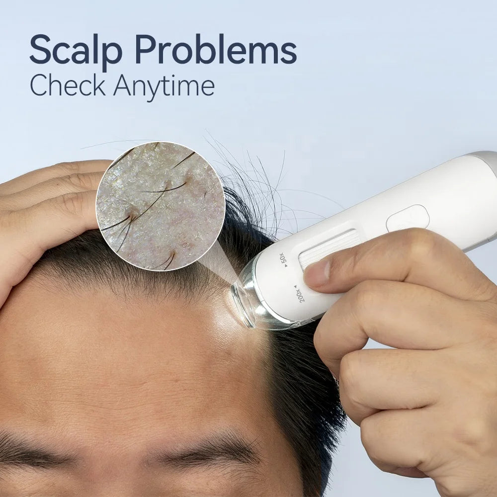 HD500X Professional Hair Testing Magnifying Glass with Camera Home Use WIFI Scalp Analyzer Follicle Hair Detector